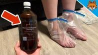 Put Hydrogen Peroxide on your FEET & WATCH WHAT HAPPENS(This is Cool and Surprising)